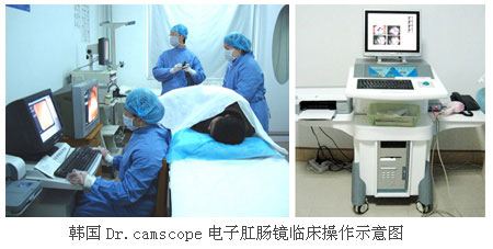 电子肛肠镜